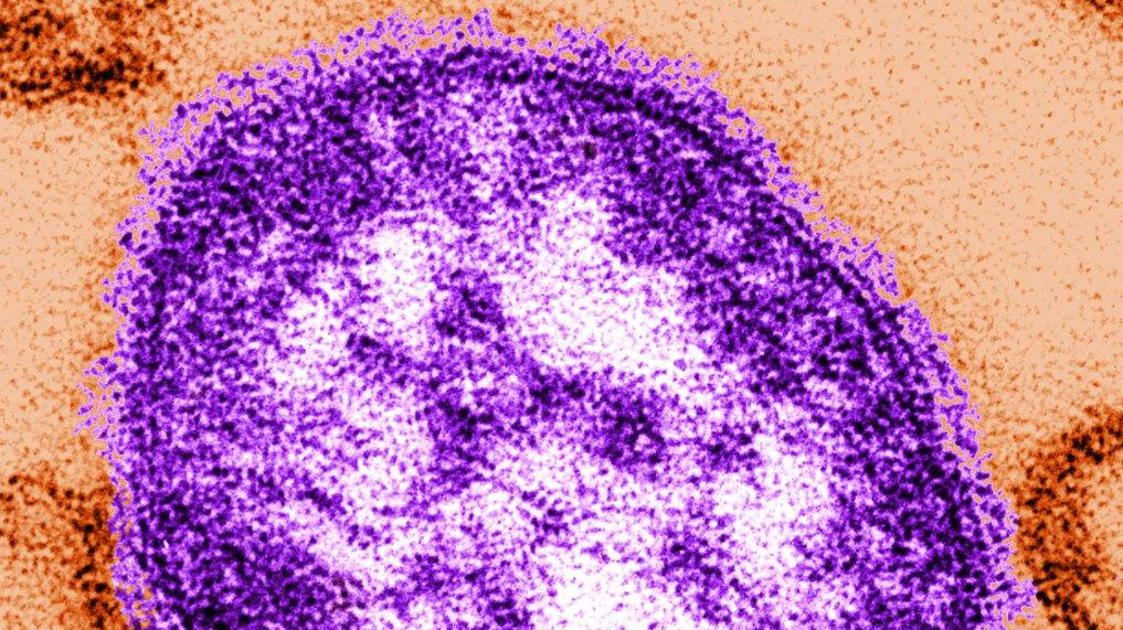 De som överlever en infektion av mässling riskerar att få ett nedsatt immunförsvar i flera år efter infektionen, visar forskning.