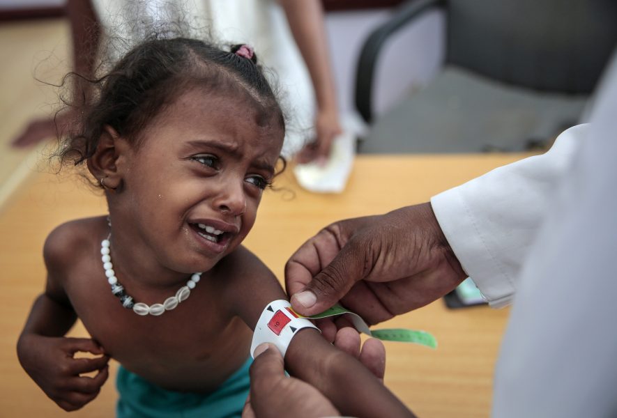 Jemen är ett av de värst hungerdrabbade länderna.
