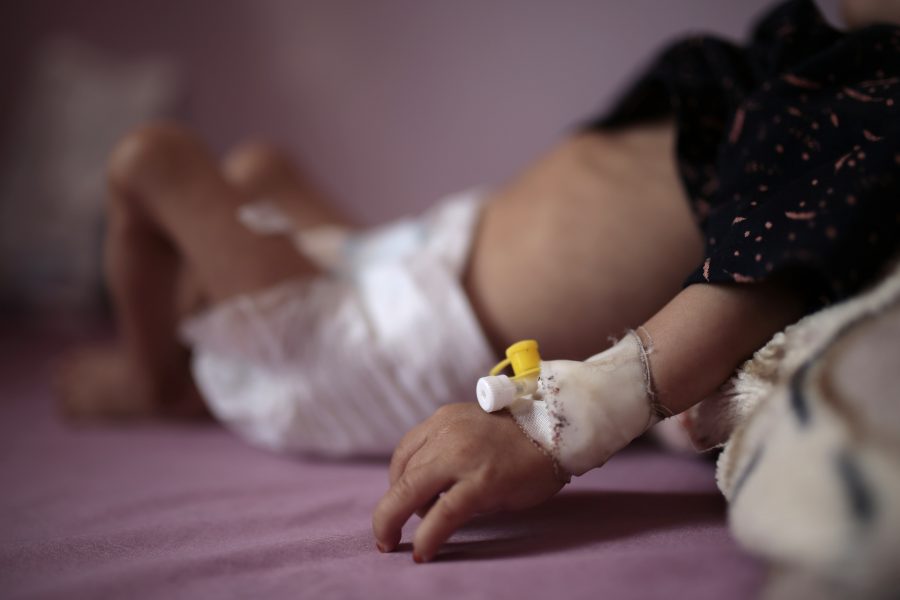 Jemen är i topp på listan över krigshärjade länder som akut behöver humanitärt stöd för att bland annat undvika svält bland barn.