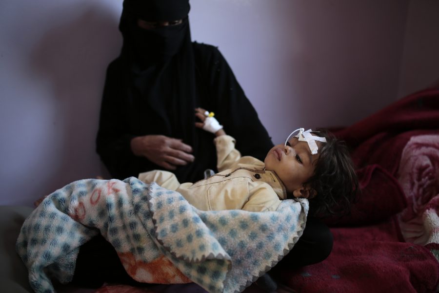 Undernärd pojke i Jemen, ett av de länder där barn drabbas värst av svält.