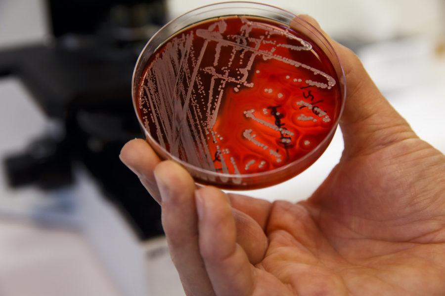 Antibiotikaresistenta bakterier i ett laboratorium.