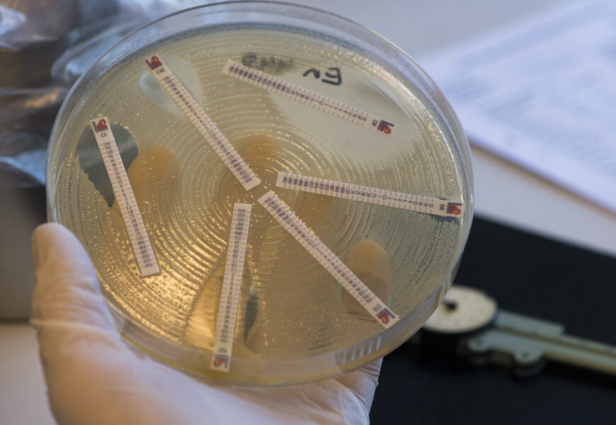 Mätning av resistens och känslighet av antibiotikas effekt på bakterier i en bakterieodling.